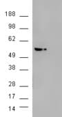 IHC-plus™ AKT3 Antibody (aa119-133)