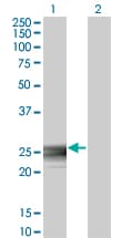 IHC-plus™ Monoclonal Mouse anti-Human RAB3B Antibody (clone 3F12, IHC, IF, WB)