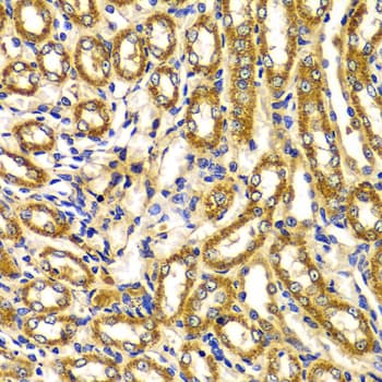 WNK3 / PRKWNK3 Antibody