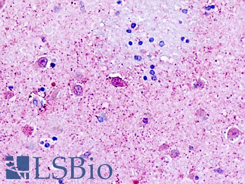 IHC-plus™ GPR162 Antibody (Transmembrane Domain)