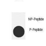 MDM2 Antibody (phospho-Thr218)