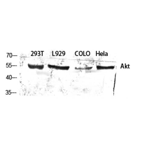 AKT1 Antibody (250-330 aa)