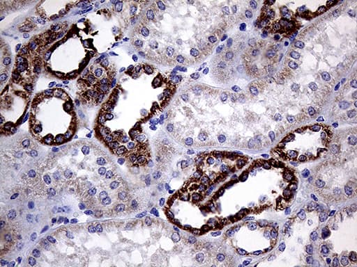Monoclonal Mouse anti-Human CLIP4 / RSNL2 Antibody (clone OTI5D10, Carrier-free, IHC, WB)