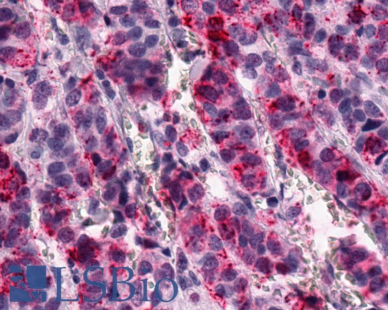 PathPlus™ Polyclonal Rabbit anti-Human GPR1 Antibody (C-Terminus, IHC)
