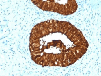 MAML3 / CAGH3 Antibody (clone MAML3/1303, Azide-free, BSA-free)