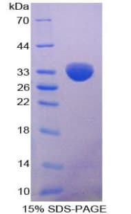 Human LPL / Lipoprotein Lipase (Recombinant His-T7)