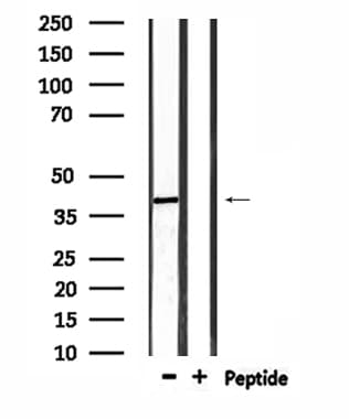 RRS1 Antibody