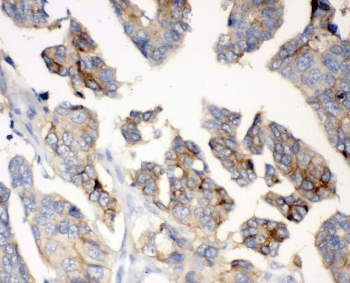 Polyclonal Rabbit anti-Human CD47 Antibody (IHC, IF, WB)