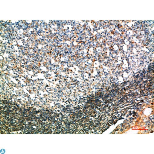 Polyclonal Rabbit anti-Human GSC / Goosecoid Antibody (IHC)