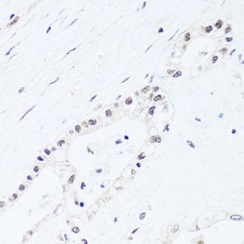 BRIX1 Antibody