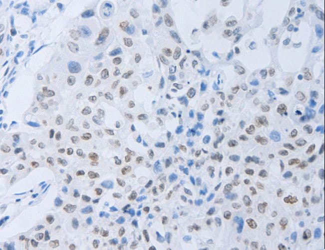 CSF1R / CD115 / FMS Antibody