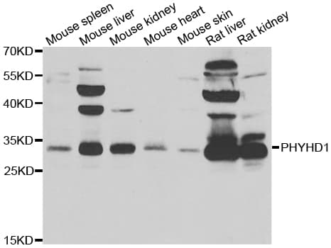 PHYHD1 Antibody