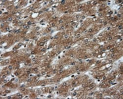 Monoclonal Mouse anti-Human PSMC3 Antibody (clone OTI1C10, IHC, IF, WB)