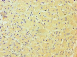 DDX3 / DDX3X Antibody (aa1-220)