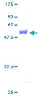Human GSTZ1 Protein (Recombinant GST)