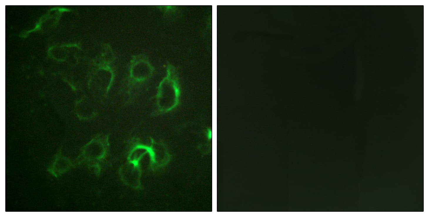SCNN1B / ENaC Beta Antibody (aa581-630)