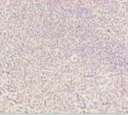 Polyclonal Rabbit anti-Human DDX11 / CHLR1 Antibody (IHC)