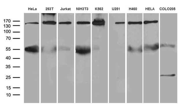 Monoclonal Mouse anti-Human SMC1A / SMC1 Antibody (clone OTI2D12, aa889-1016, IHC, WB)