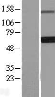 EDC3 Protein (Over-Expression Lysate Myc-DDK (Flag))
