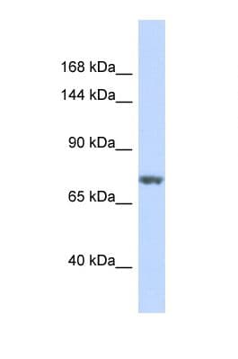 Polyclonal Rabbit anti-Human BCL11B Antibody (aa459-508, WB)