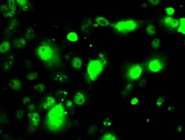 RPA2 / RFA2 / RPA34 Antibody (clone OTI8B3)