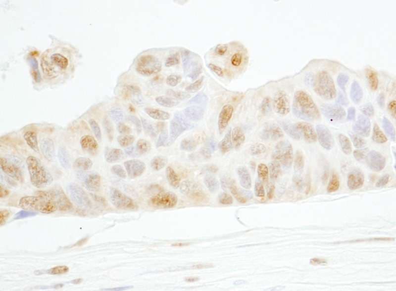 CCNE1 / Cyclin E1 Antibody (aa360-410)