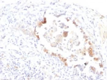 Monoclonal Mouse anti-Human Lewis y / BG8 / CD174 Antibody (clone LWY/1463, IHC, IF)