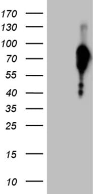FOXO1 / FKHR Antibody (aa356-655, clone OTI2H4, Carrier-free)