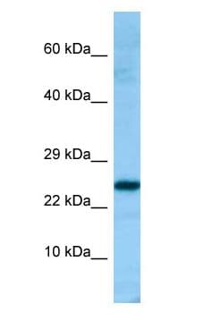 PRDX4 / Peroxiredoxin 4 Antibody (aa201-250)