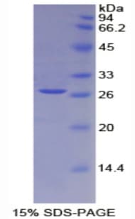 Rat IL2RA / CD25 Protein (Recombinant 6His, N-terminus)