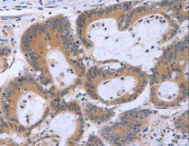 MAPRE3 / EB3 Antibody