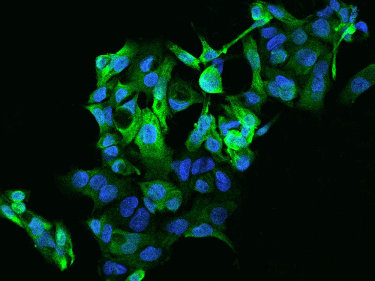 Polyclonal Rabbit anti-Human ADH4 Antibody (IF)
