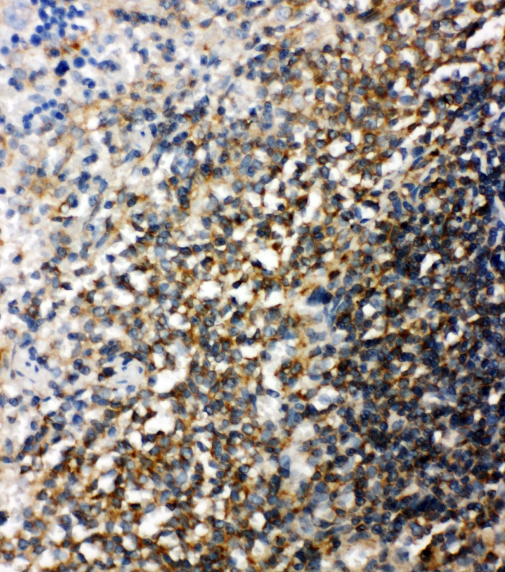 Polyclonal Rabbit anti-Mouse BID Antibody (aa179-195, IHC, WB)