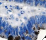 Monoclonal Mouse anti-Human EMA / MUC1 Antibody (IHC)