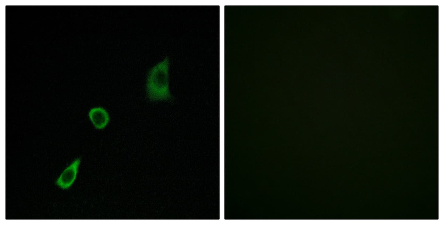 FGF23 Antibody (aa151-200)