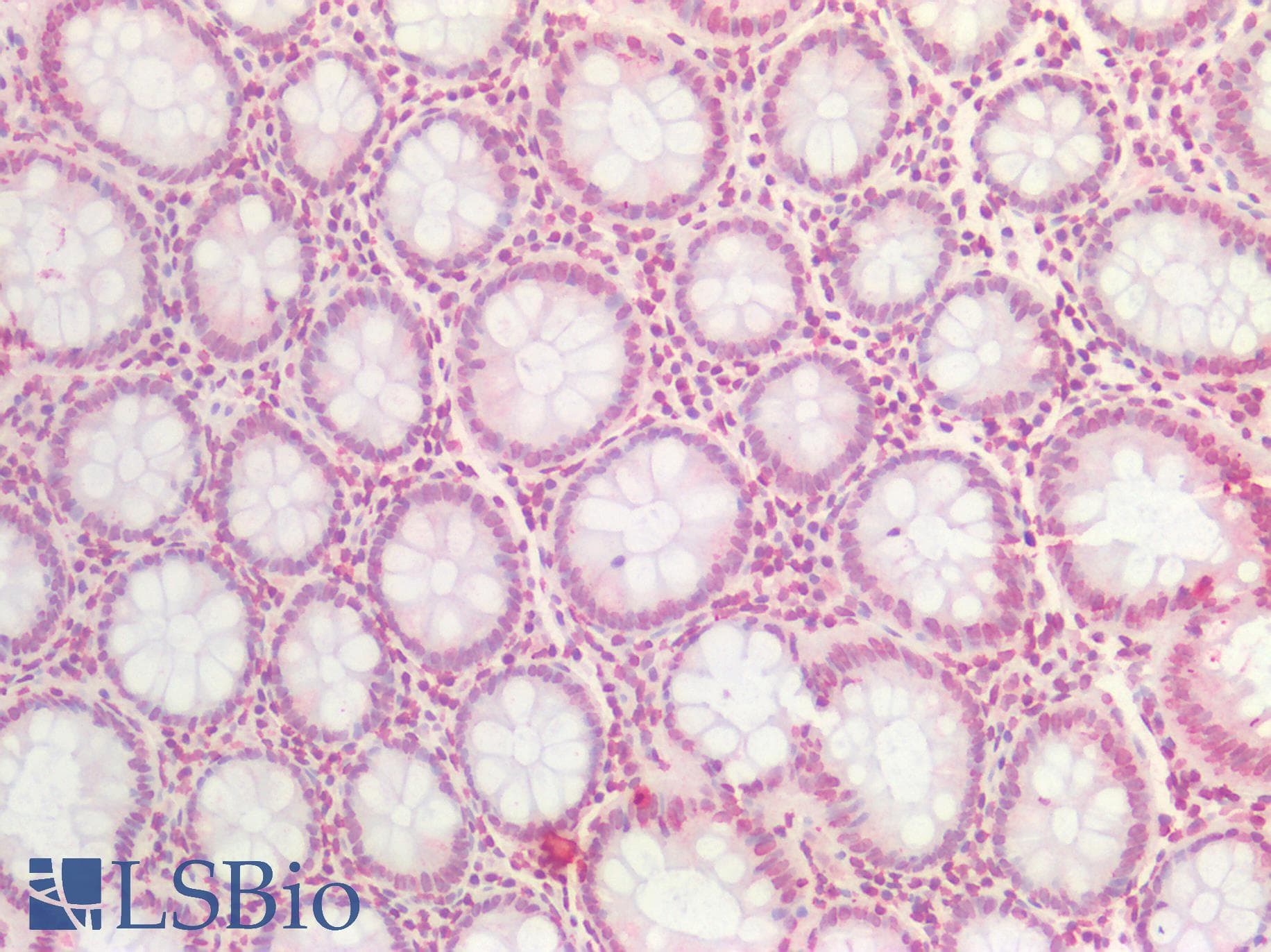 IHC-plus™ BMI1 / PCGF4 Antibody (aa303-315)