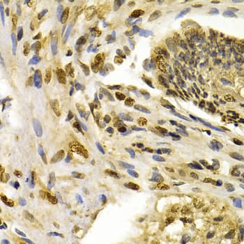 IFIH1 / MDA5 Antibody