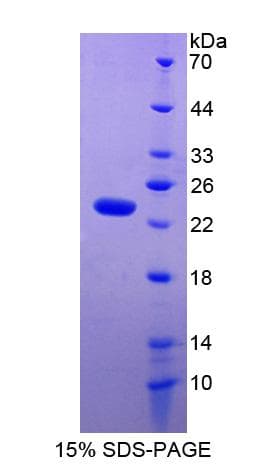 Rat TIMP1 Protein (Recombinant His)
