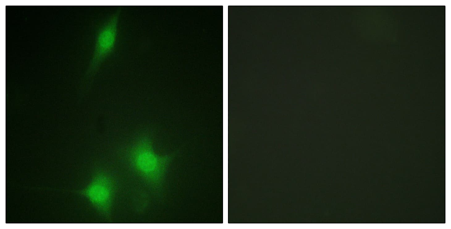 MDM2 Antibody (aa151-200)