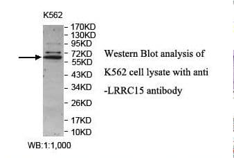 LRRC15 Antibody (aa27-449)