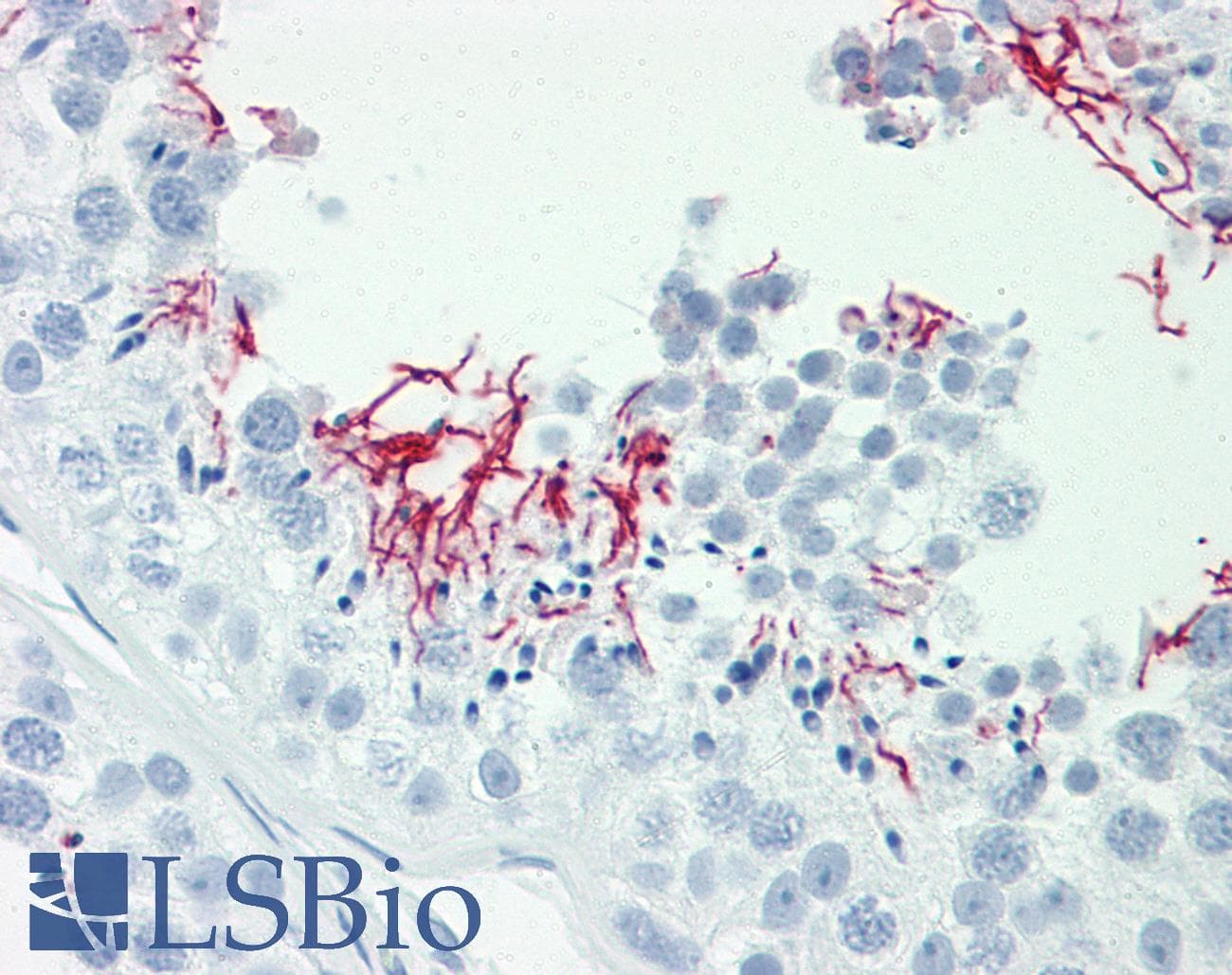 IHC-plus™ Polyclonal Rabbit anti-Human GAK Antibody (aa101-150, IHC, WB)