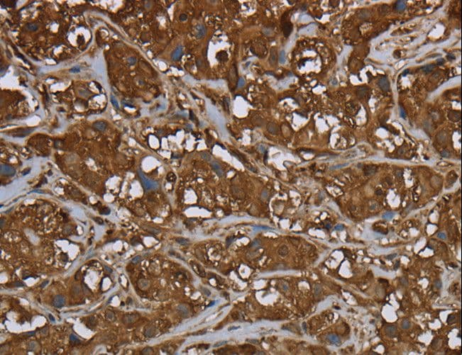 ARHGDIA / RHOGDI Antibody