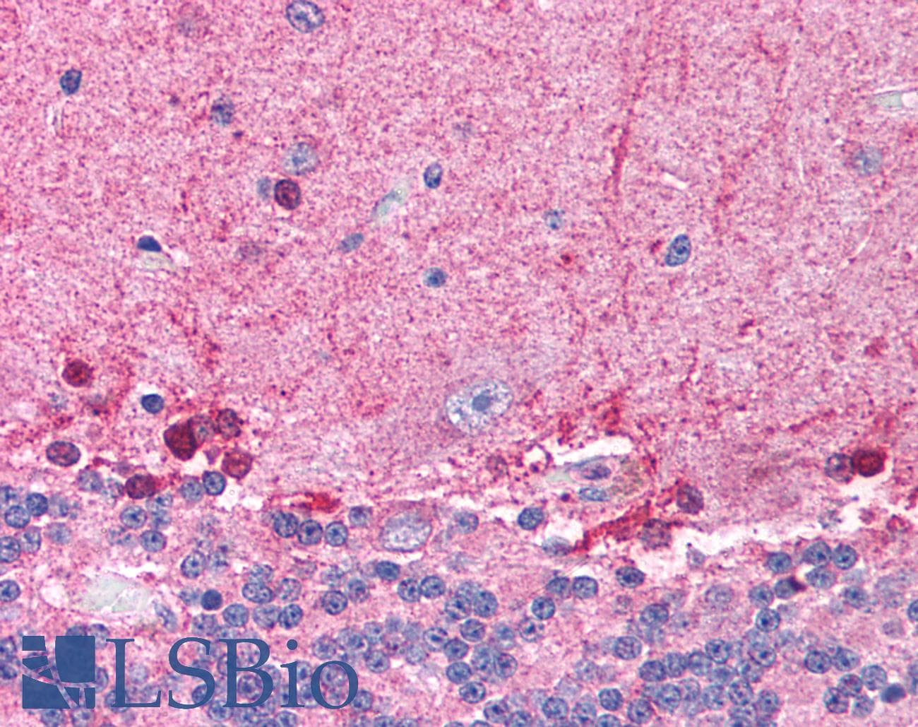 Polyclonal Rabbit anti-Human HDAC8 Antibody (C-Terminus, IHC, WB)