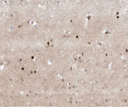 TFE3 Antibody