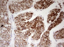 HADH Antibody (aa57-314, clone OTI7C9)