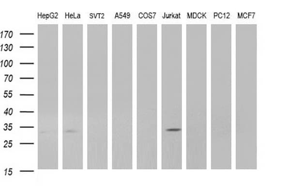 ANKRD49 Antibody (clone OTI3E4)