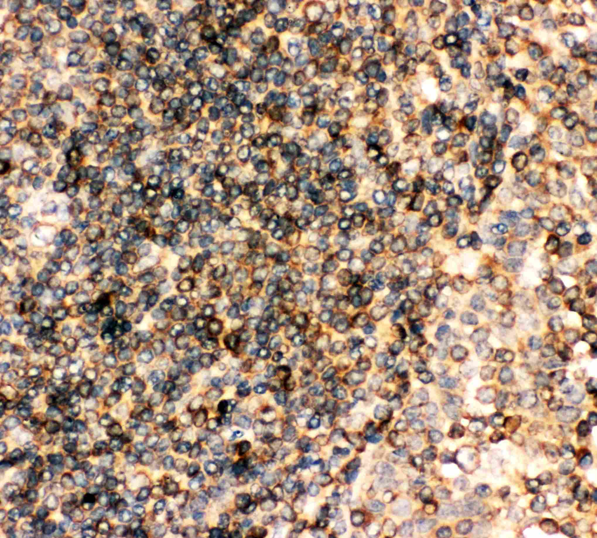 FCER2 / CD23 Antibody (aa50-331)