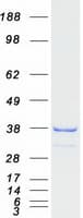 Human CCDC44 / TACO1 Protein (Recombinant Myc-DDK (Flag))