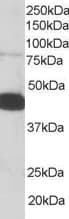 IHC-plus™ PLEK / Pleckstrin Antibody (aa337-350)