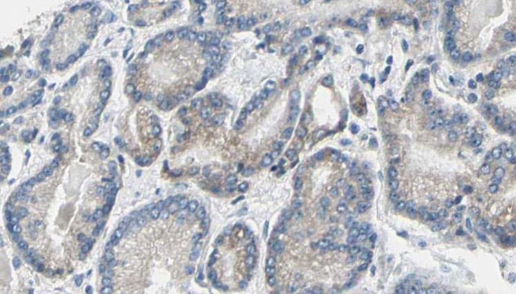 GSK3A / GSK3 Alpha Antibody